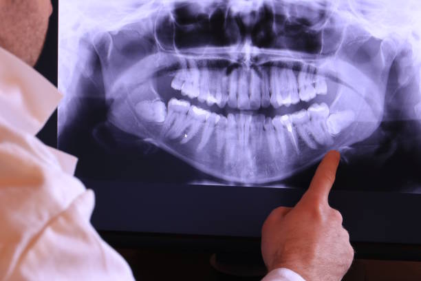 Best Emergency Root Canal Treatment in Castlewood, VA