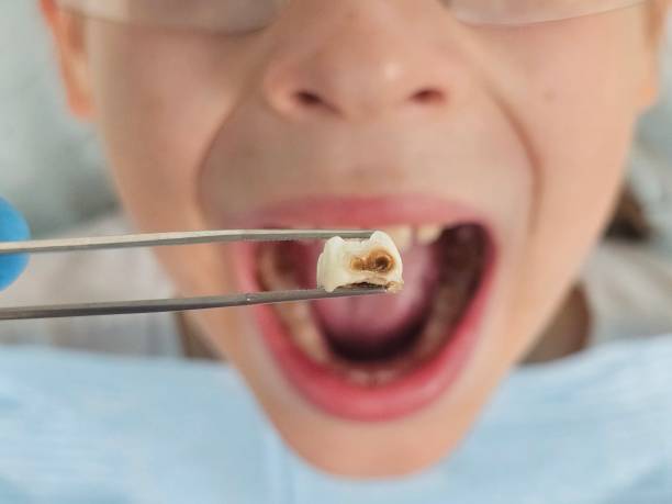 Best Orthodontic Emergency Dentist in Castlewood, VA